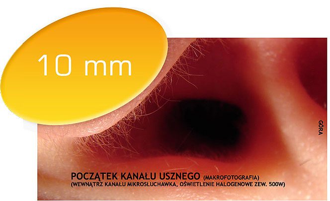 Wejście do kanału usznego z oznaczeniem 10 mm